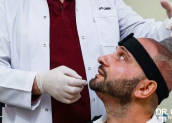 Exploring Competitive Hair Transplant Prices In Istanbul