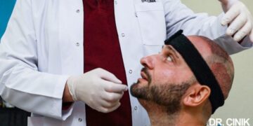 Exploring Competitive Hair Transplant Prices In Istanbul