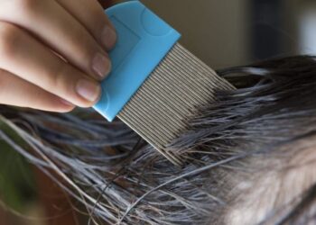 Best Lice Removal Clinics And Services In Westchester