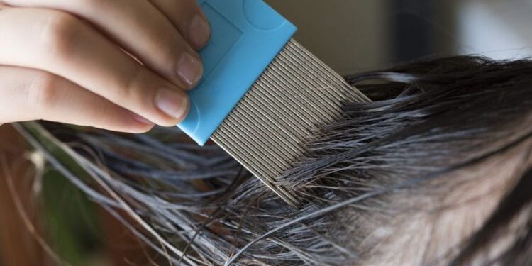 Best Lice Removal Clinics And Services In Westchester